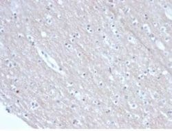 SATB2 Mouse anti-Human, Clone: rSATB2/6929, Novus Biologicals 100 &mu;g;